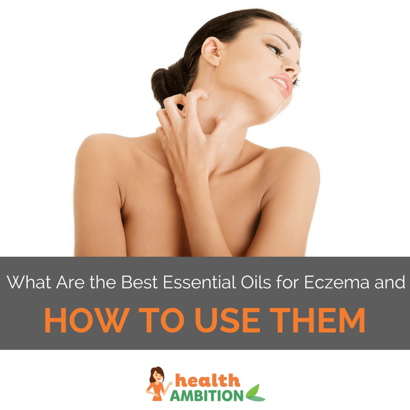 Eczema-1