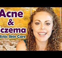 (Video) Natural Acne And Eczema Remedies