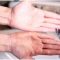 10 Remedies To Remove Tan From Hands