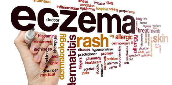 What Are the Best Essential Oils for Eczema and How to Use Them